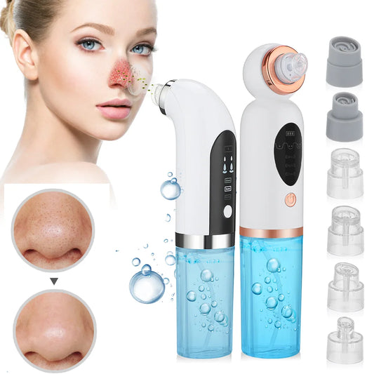 Electric Blackhead Remover